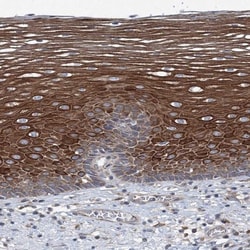 MPHOSPH9- Antibody, Novus Biologicals:Antibodies:Primary Antibodies